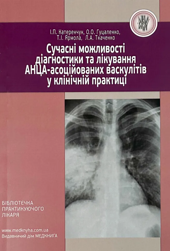 Сучасні можливості діагностики та лікування АНЦА-асоційованих васкулітів у клінічній практиці